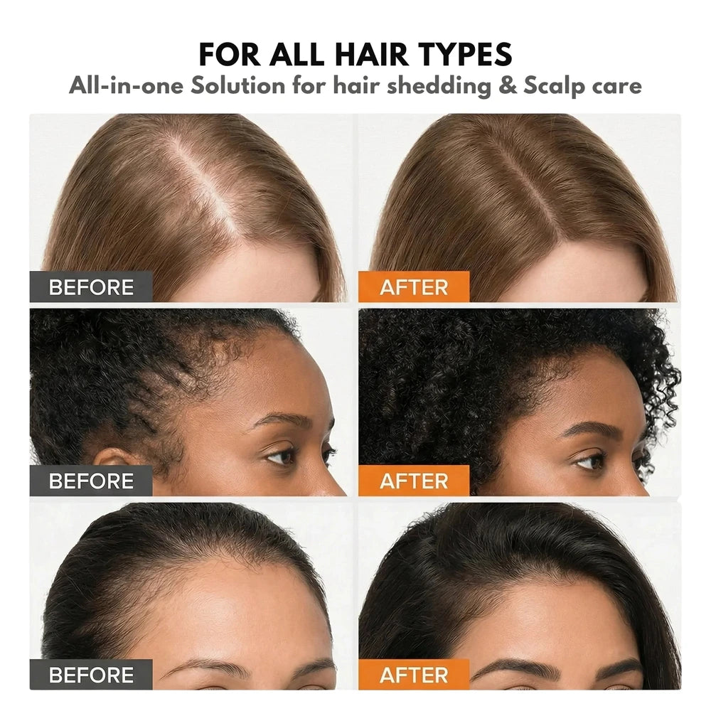 Korea Hair Growth Serum