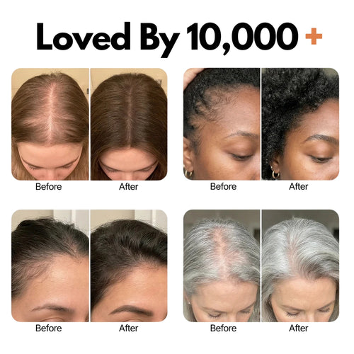 Korea Hair Growth Serum